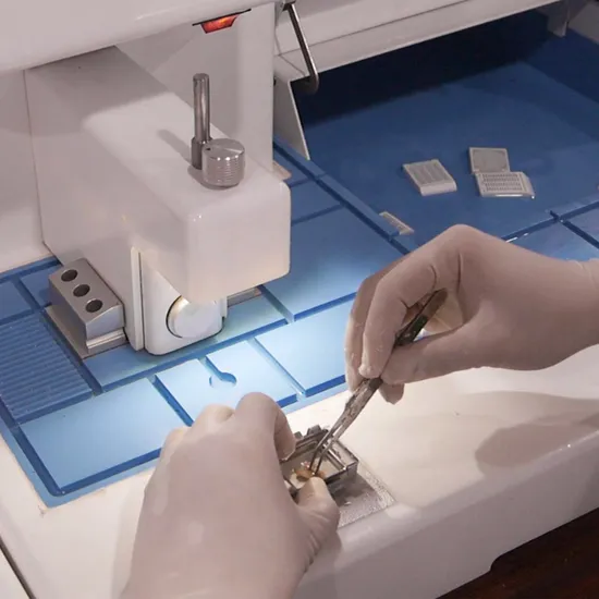 Centres d'intégration Machine Medical X Ray Rayau audiomètre audiomètre GlyCose Bloody Montorat Portable Analyser les centres d'intégration